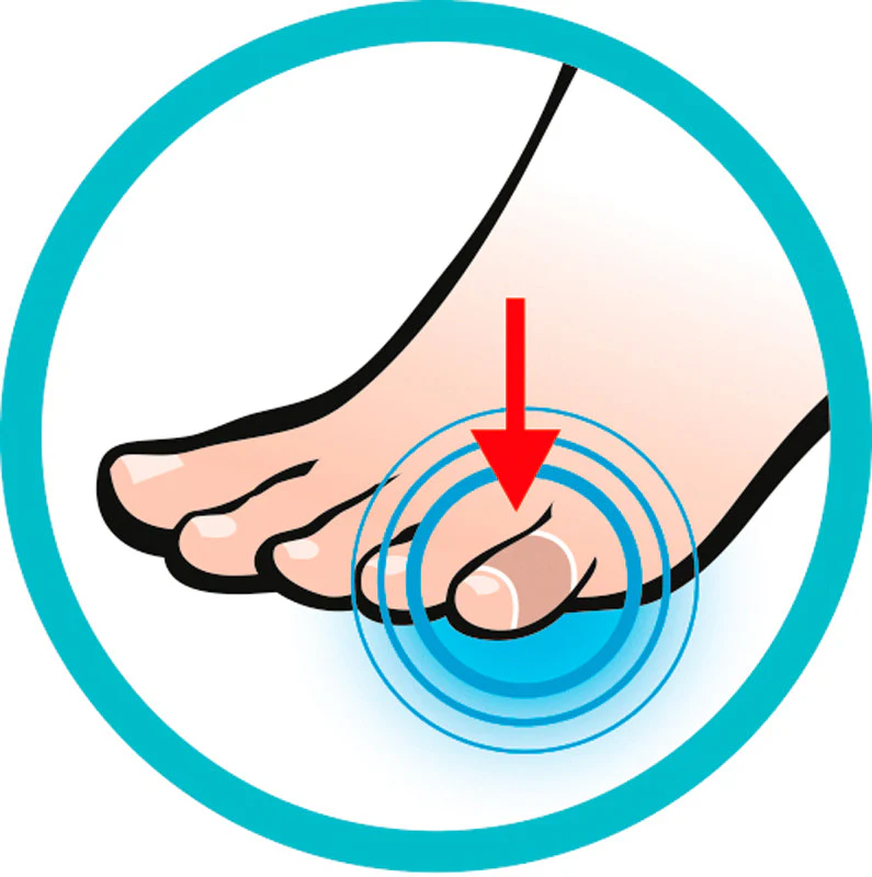 Toe Protectors - Image 3